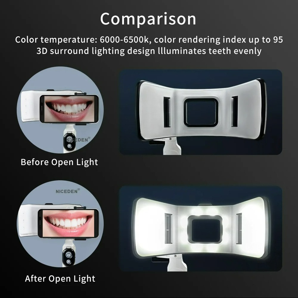 ضوء تصوير الأسنان للهاتف مع تق - مراجعة Photography Dental وسعره